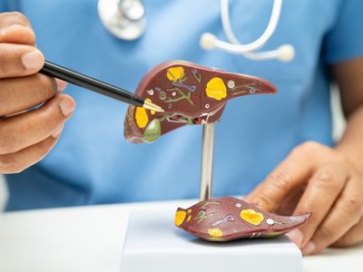 Comment soulager un foie saturé ?
Ménopause et sucre : Guide complet des bienfaits et solutions